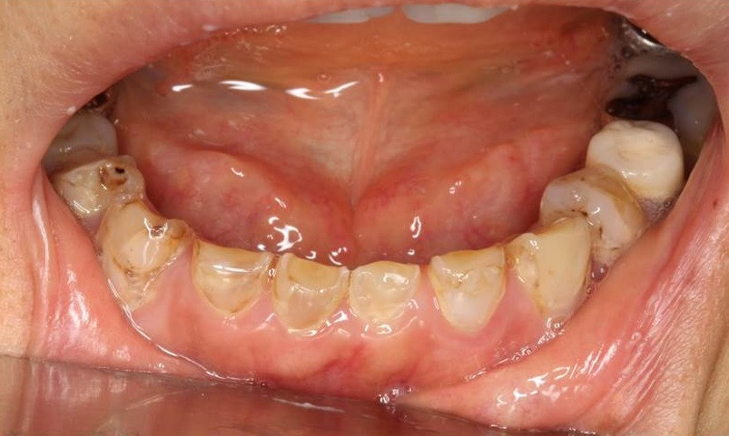 流山の歯科医院で酸蝕症の専門治療が受けられます。