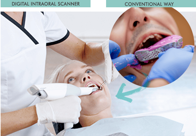 流山の歯科医院で「デジタル加工技術によるCAD/CAM冠」治療が受けられます。