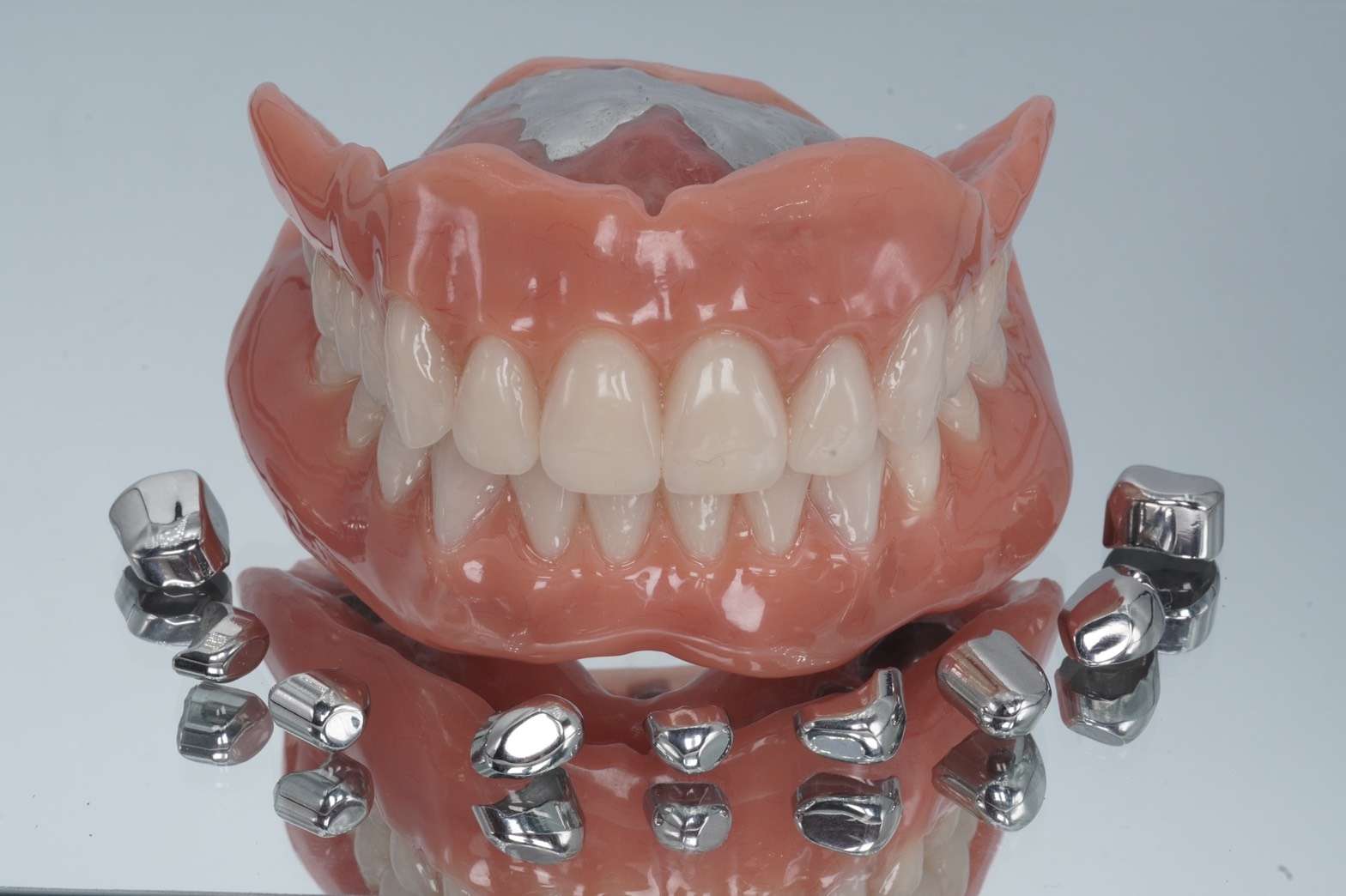 流山の歯科医院でドイツ式入れ歯「テレスコープデンチャー」での治療法を提案しております。